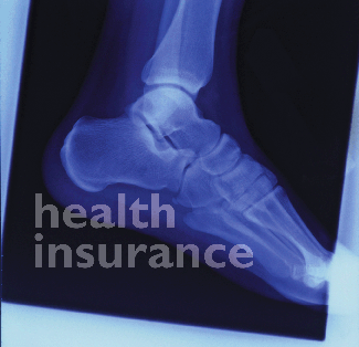 Medical health insurances